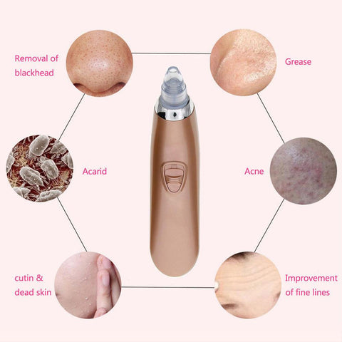 Electric Face Pore Cleaner