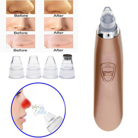 Electric Face Pore Cleaner