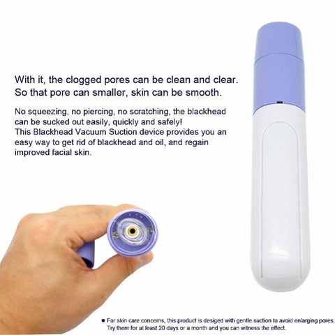 Blackheads & Acne Sucker Remover
